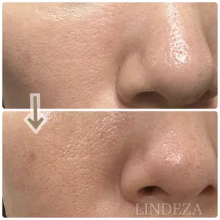 private salon 𝐋𝐈𝐍𝐃𝐄𝐙𝐀所属・LINDEZA Ayaのエステ・リラクイメージ