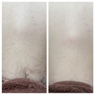 Sola所属・岡島 奈美のエステ・リラクイメージ