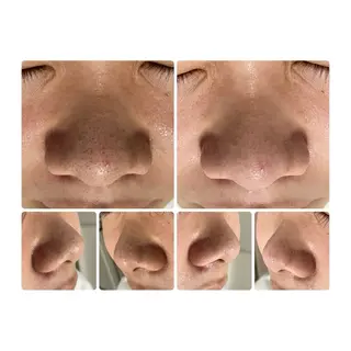 beauty salon nana所属・beauty salon nanaのエステ・リラクイメージ