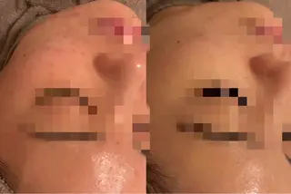 RUA YUIのエステ・リラクイメージ