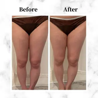 12Dハイフ💗 最強小顔のエステ・リラクイメージ