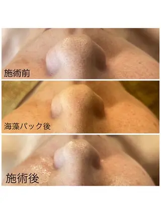 🌼SALON Lazuli久留米のエステ・リラクイメージ