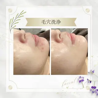 《 肌質×美肌 》 addissimoのエステ・リラクイメージ