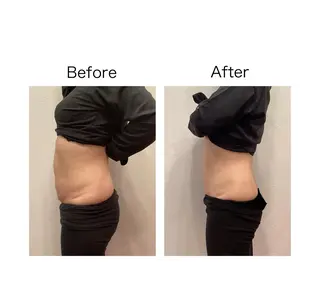 小顔サロンSharp …腸調整よもぎ蒸しのエステ・リラクイメージ