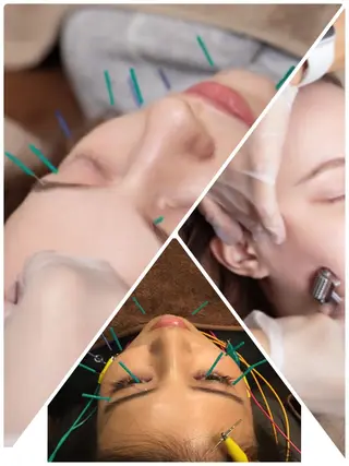 表参道鍼灸院K 美容鍼🔮ララピールのエステ・リラクイメージ