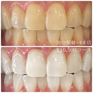 PLATINUM Beauty 横浜店所属・ホワイトニングルーム 横浜店のその他イメージ