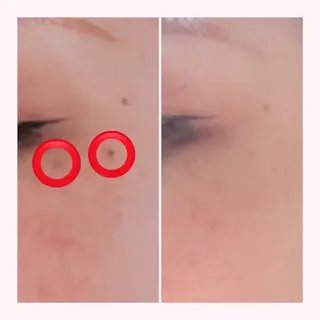 MORE BEAUTY ESTHE 本通り店所属・more 𓍯 のエステ・リラクイメージ