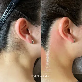 HOTEL&PARK . ワックス脱毛のエステ・リラクイメージ