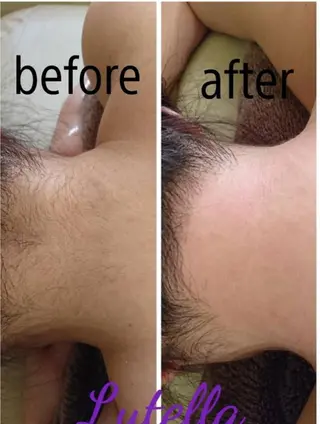 Lutella所属・ワックス脱毛専門店 Lutellaのエステ・リラクイメージ