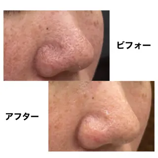 Coco Calin 𓇼山脇愛のエステ・リラクイメージ