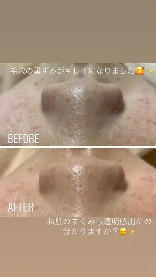 グランデ ルシアルのエステ・リラクイメージ