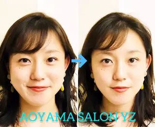 小顔美容鍼専門サロン 渋谷YZのその他イメージ