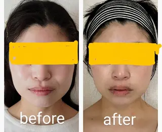 小顔矯正夙川 カレーズのエステ・リラクイメージ