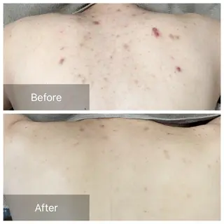 BERRY所属・サロン BERRYのエステ・リラクイメージ