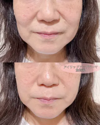 マツエク・マツパ merveilles所属・まつげ/整体/にきび ・アトピー専門サロンのマツエク・マツパデザイン