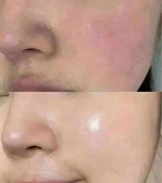 マツエク・マツパ aliaハイフ&水光ジェットサロン所属・aliaハーブ水光店 エステティシャン募集のエステ・リラクイメージ