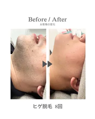 メンズ エステサロンNarcis〜ナルシス〜所属・脱毛＆痩身エステ Narcisのエステ・リラクイメージ