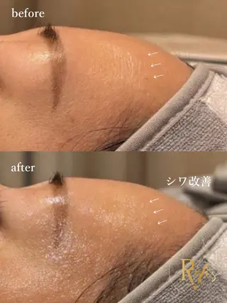 新石切ravis - ラヴィス -のその他イメージ