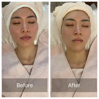 Lis Roseフェイシャルサロン所属・Lis Rose🥀 フェイシャルサロンのエステ・リラクイメージ