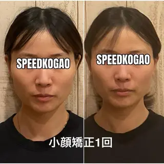 小顔矯正Speed KOGAO渋谷本店のエステ・リラクイメージ