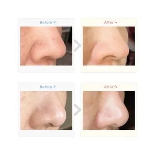 NAYU/レディース 眉毛/堺筋本町の眉毛・アイブロウイメージ