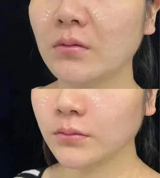 ネイル aliaハイフ&水光ジェットサロン所属・aliaハーブ水光店 エステティシャン募集のエステ・リラクイメージ