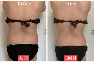 ララ/ハーブ メゾンリュバンのエステ・リラクイメージ