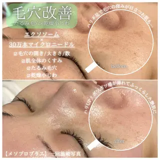 La Dusa 韓国肌管理/小波のエステ・リラクイメージ