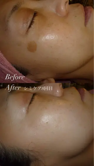 # fu♡のエステ・リラクイメージ