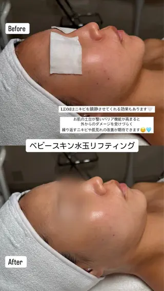 韓国肌管理🫧LDM 🫧Junnaのエステ・リラクイメージ