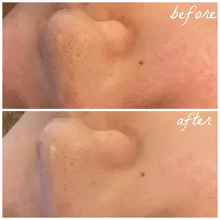 メンズ メナード岐阜市茜部 杉浦のエステ・リラクイメージ