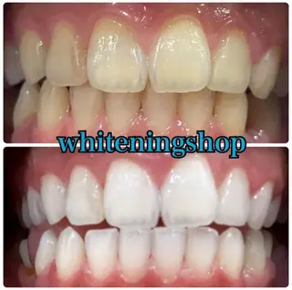 ホワイトニングショップ時津店所属・ホワイトニング ショップ長崎時津店のその他イメージ