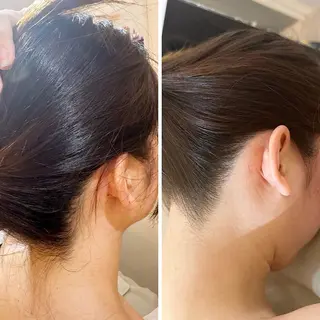 うなじ脱毛/美肌脱毛 LABELのエステ・リラクイメージ