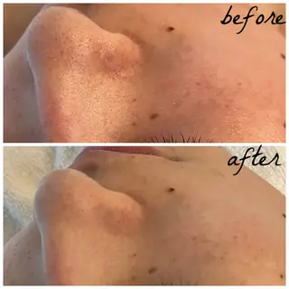 メンズ メナード岐阜市茜部 杉浦のエステ・リラクイメージ