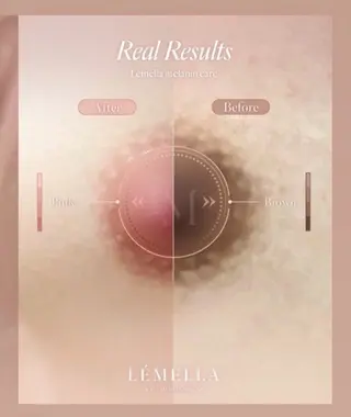 MiMi所属・ヘアセット/ネイル/ メラニンケア/えりかのネイルデザイン