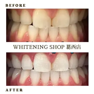 メンズ ホワイトニング ショップ葛西店のその他イメージ