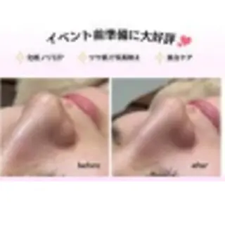 🌿小顔・痩身・脱毛 レイビス川崎店🌿のエステ・リラクイメージ