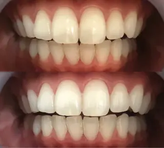 LBSホワイトニング上野店所属・LBSホワイトニング 🌐 上野店公式のエステ・リラクイメージ