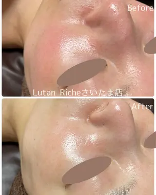Lutan Richeさいたま店所属・ルタンリッシュ さいたま店のエステ・リラクイメージ