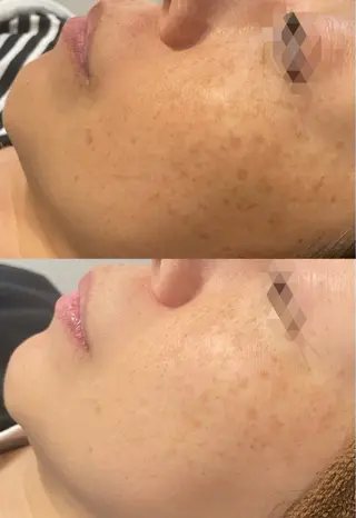 シミケア専門店モルセラ所属・シミケア専門店 モルセラのエステ・リラクイメージ