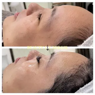 マツエク・マツパ ビューティー ミロワールのエステ・リラクイメージ