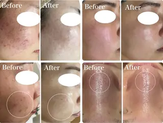 脱毛&フェイシャル 専門店muro.のエステ・リラクイメージ