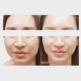 看護師 AYUIのエステ・リラクイメージ