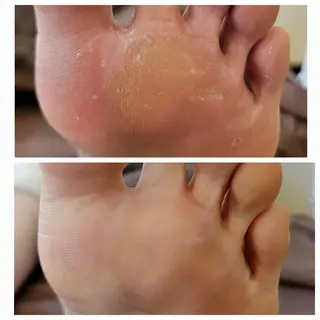 ネイル&巻き爪サロン 　AKnailのネイルデザイン