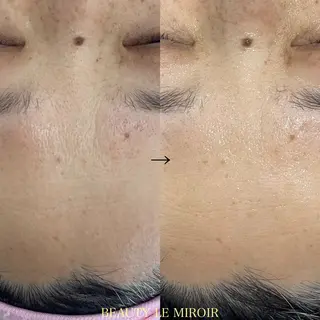 ビューティー ミロワールのエステ・リラクイメージ