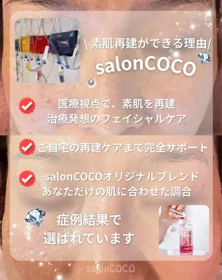 salonCOCO所属・素肌再建看護師💎 salonCOCOのエステ・リラクイメージ