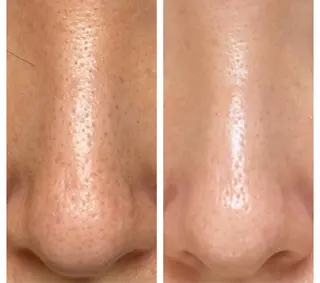 NORI @myuの眉毛・アイブロウイメージ