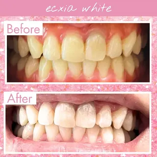 セルフホワイトニングエクシアホワイト草加店所属・セルフホワイトニング エクシア草加店のその他イメージ