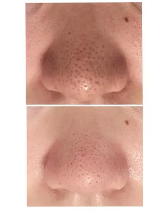 毛穴シミ改善専門 サロンド・ルパークのエステ・リラクイメージ