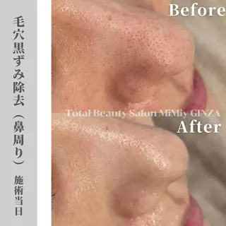 MiMiy 銀座店のエステ・リラクイメージ